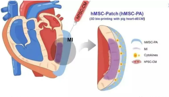 真實案例：上億個幹細胞進入心髒受損區(qū)域後，他(tā)的心髒病......(圖8)